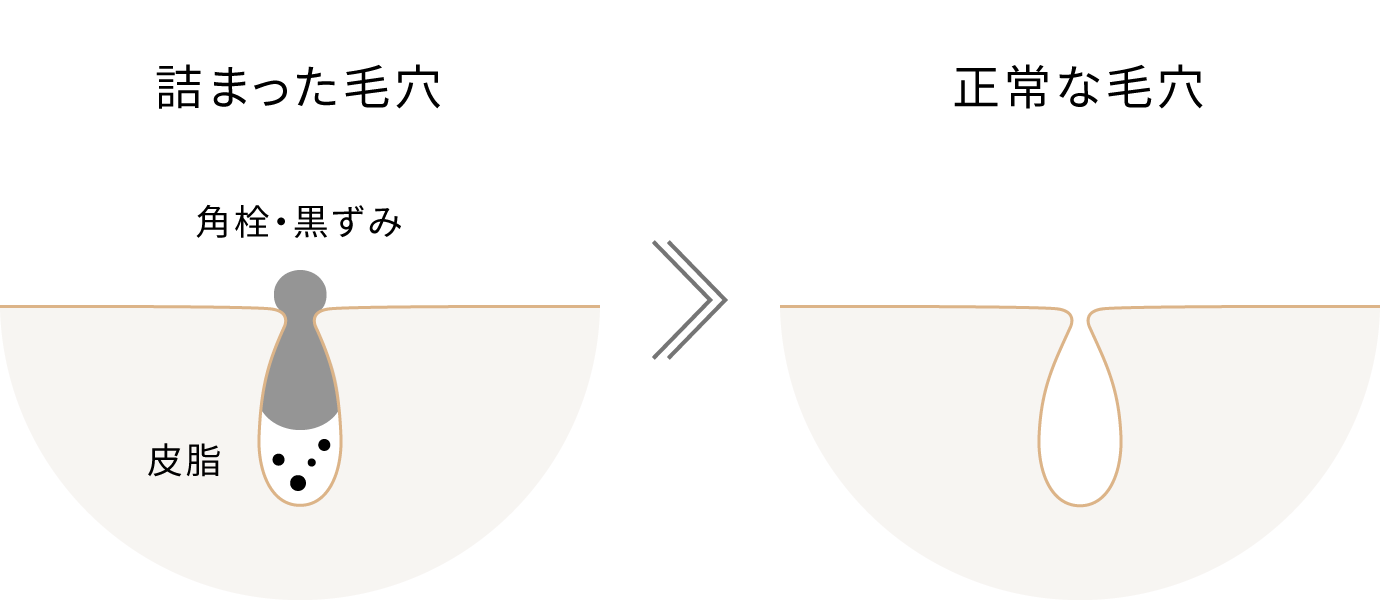 POINT1の説明図